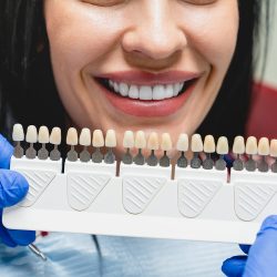 Veneers Teeth Process